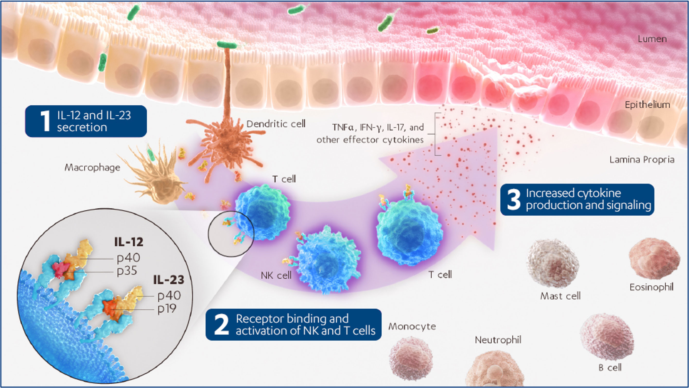 Focus on IL-12/23 Pathways